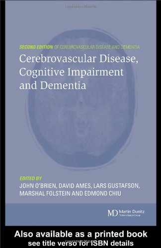 Cerebrovascular Disease Cognitive Impairment And Dementia 2nd Ed John Obrien