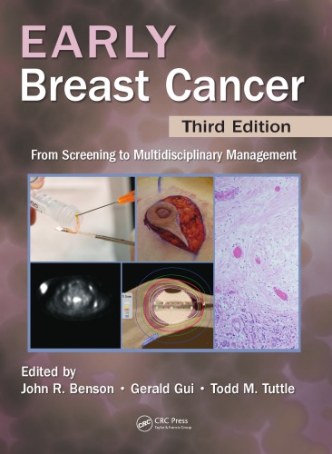 Early Breast Cancer From Screening To Multidisciplinary Management 3rd Ed Benson