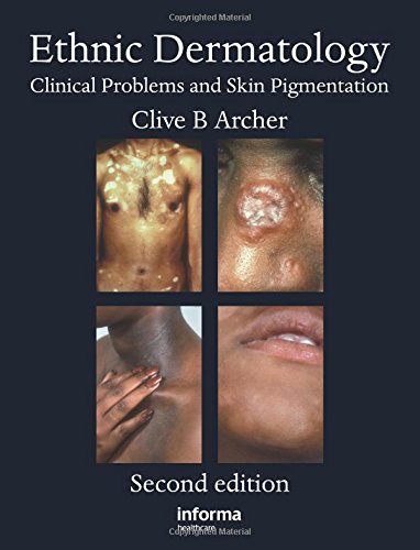 Ethnic Dermatology Clinical Problems And Pigmented Skin 2nd Ed Archer
