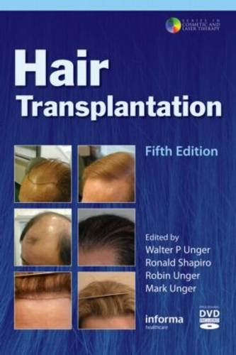 Hair Transplantation 5th Ed Walter P Unger Ronald Shapiro Robin Unger