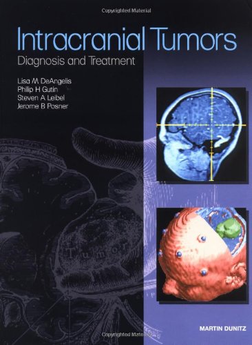Intracranial Tumors Diagnosis And Treatment 1st Edition Lisa M Deangelis