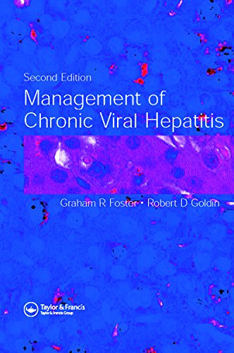Management Of Chronic Viral Hepatitis Second Edition Foster Graham R