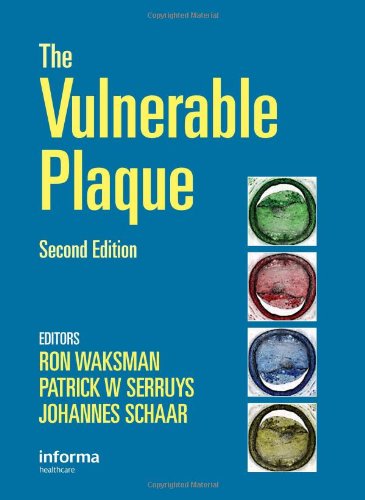 The Vulnerable Plaque Second Edition 2nd Edition Ron Waksman
