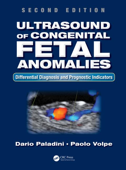 Ultrasound Of Congenital Fetal Anomalies Differential Diagnosis And Prognostic Indicators 2nd Edition Dario Paladini