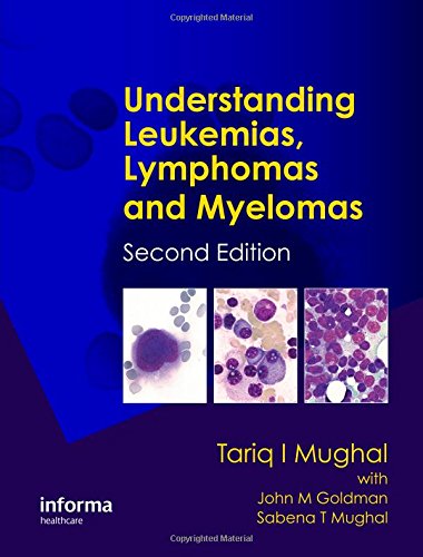Understanding Leukemias Lymphomas And Myelomas 2nd Ed Tariq I Mughal