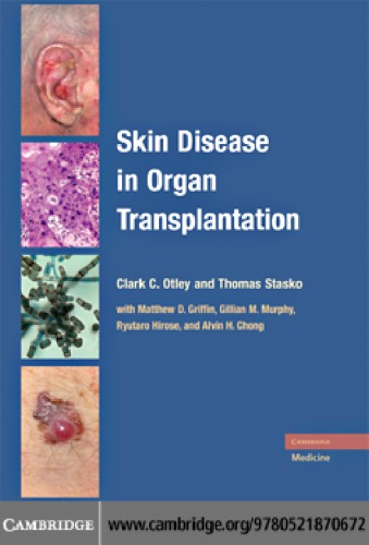 Skin Disease In Organ Transplantation Otley Clark C