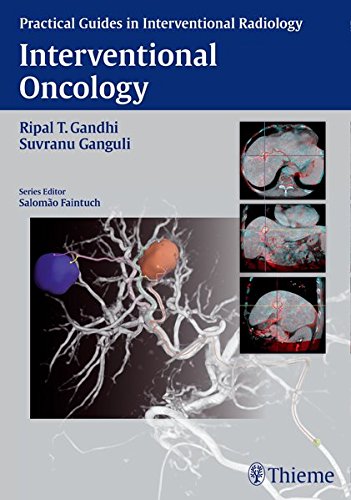Interventional Oncology 1st Edition Faintuch Salomo Gandhi