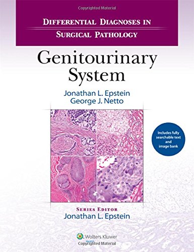 Differential Diagnoses In Surgical Pathology Genitourinary System First Jonathan I Epstein