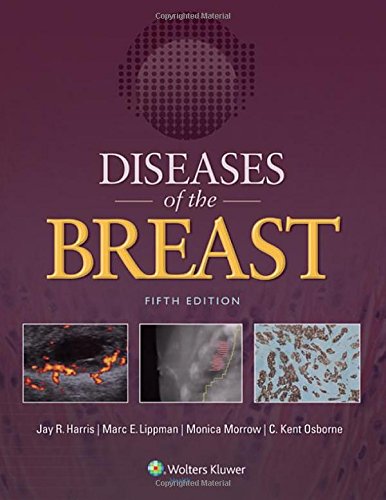Diseases Of The Breast Fifth Edition Jay R Harris Md Jay R Harris Md