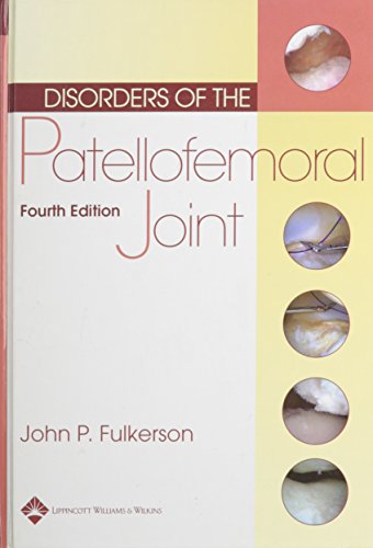 Disorders Of The Patellofemoral Joint 4th Ed Buuck David A Fulkerson