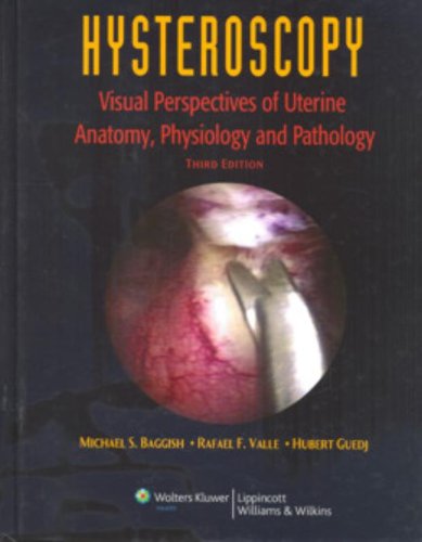 Hysteroscopy Visual Perspectives Of Uterine Anatomy Physiology And Pathology 3rd Ed Michael S Baggish Md