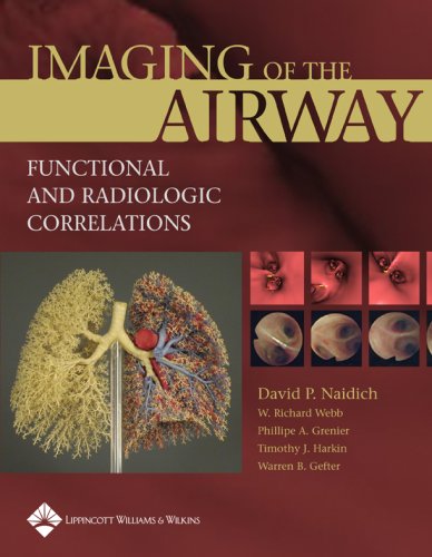 Imaging Of The Airways Functional And Radiologic Correlations 1st Edition David P Naidich