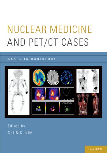 Nuclear Medicine And Petct Cases Cases In Radiology 1st Edition Chun K Kim