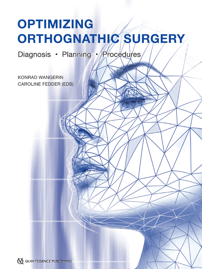 Optimizing Orthognathic Surgery Diagnosis Planning Procedures Wangerin Konrad Caroline Fedder