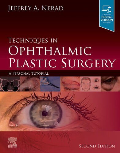 Techniques In Ophthalmic Plastic Surgery A Personal Tutorial 2nd Edition Jeffrey A Nerad Md
