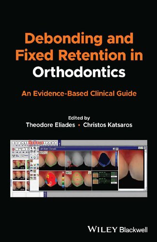 Debonding And Fixed Retention In Orthodontics An Evidencebased Clinical Guide Teamira 1st Edition Theodore Eliades Editor