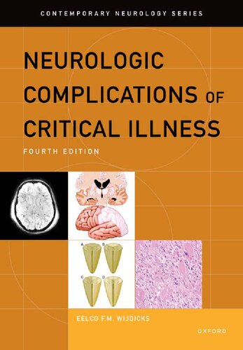 Neurologic Complications Of Critical Illness Contemporary Neurology Series Teamira 4th Edition Eelco Fm Wijdicks