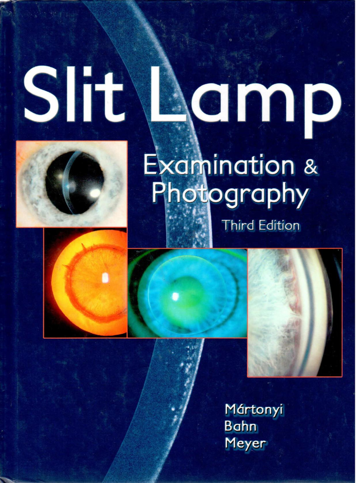 Slit Lamp 3rd Edition Csaba L Martonyi Charles F Bahn Roger F Meyer