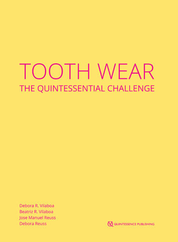 Tooth Wear The Quintessential Challenge Dbora R Vilaboa Beatriz R Vilaboa