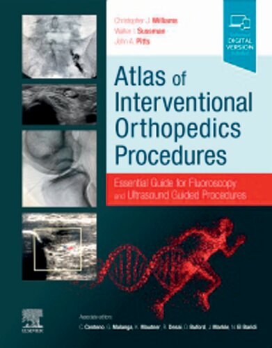 Atlas Of Interventional Orthopedics Procedures Essential Guide For Fluoroscopy And Ultrasound Guided Procedures 1st Edition Christopher J Williams Md Editor