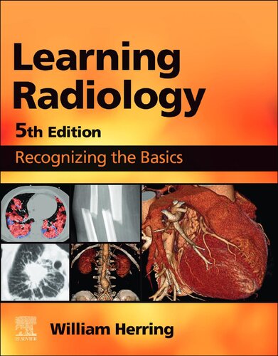 Learning Radiology Recognizing The Basics 5th Edition 5th William Herring