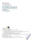 Dc Duttas Textbook Of Gynecology 6th Edition Hiralal Konar D C Dutta