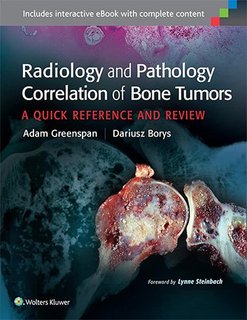 Radiology And Pathology Correlation Of Bone Tumors A Quick Reference And Review Adam Greenspan