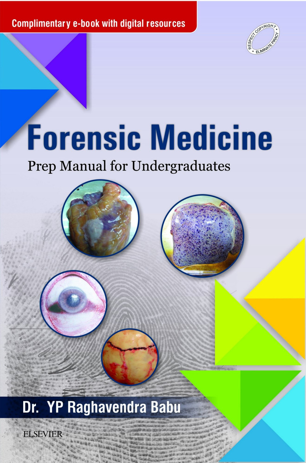 Forensic Medicine Prep Manual For Undergraduates 1st Edition Dr Yp Raghavendra Babu