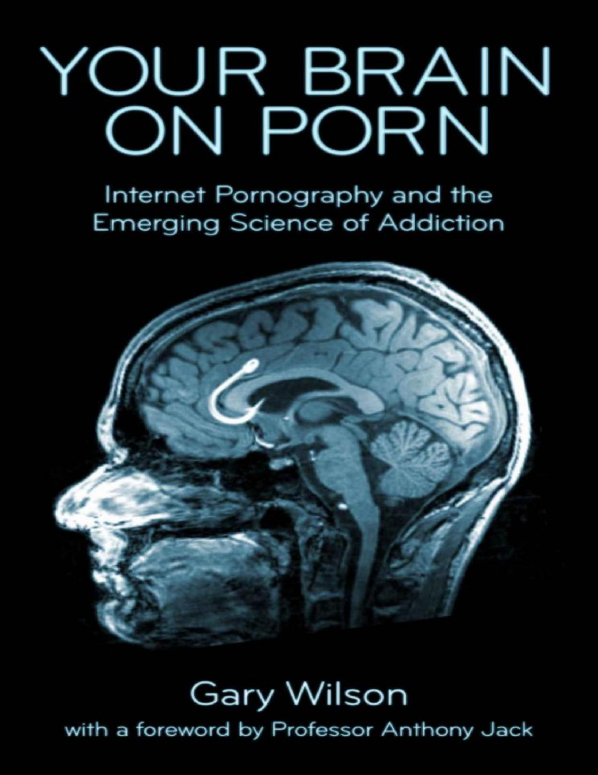 Your Brain On Porn Internet Pornography And The Emerging Science Of Addiction Gary Wilson