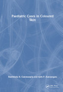 Paediatric Cases In Coloured Skin Ranthilaka R Gammanpila Ajith P Kannangara