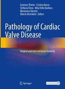 Pathology Of Cardiac Valve Disease Surgical And Interventional Anatomy Gaetano Thiene