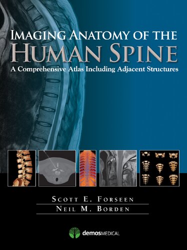Imaging Anatomy Of The Human Spine A Comprehensive Atlas Including Adjacent Structures Scott E Forseen Neil M Borden
