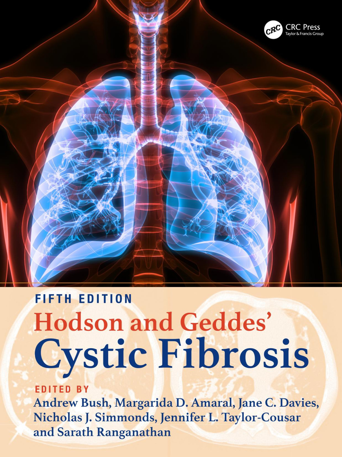 Hodson And Geddes Cystic Fibrosis 5th Edition 5th Andrew Bush