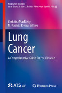 Lung Cancer A Comprehensive Guide For The Clinician Christina Macrosty
