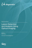 Lesion Detection And Analysis Using Optical Imaging Viktor Dremin Editor
