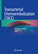 Transarterial Chemoembolization Tace Pierleone Lucatelli