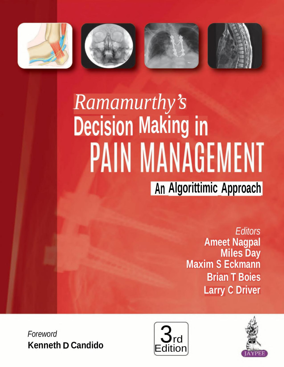 Ramamurthys Decision Making In Pain Managementan Algorithmic Approach 3e Jul 1 20189386261456jaypee Brothers Medical Pub Ameet Nagpal