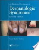 An Illustrated Dictionary Of Dermatologic Syndromes 2nd Edition Susan B Mallory