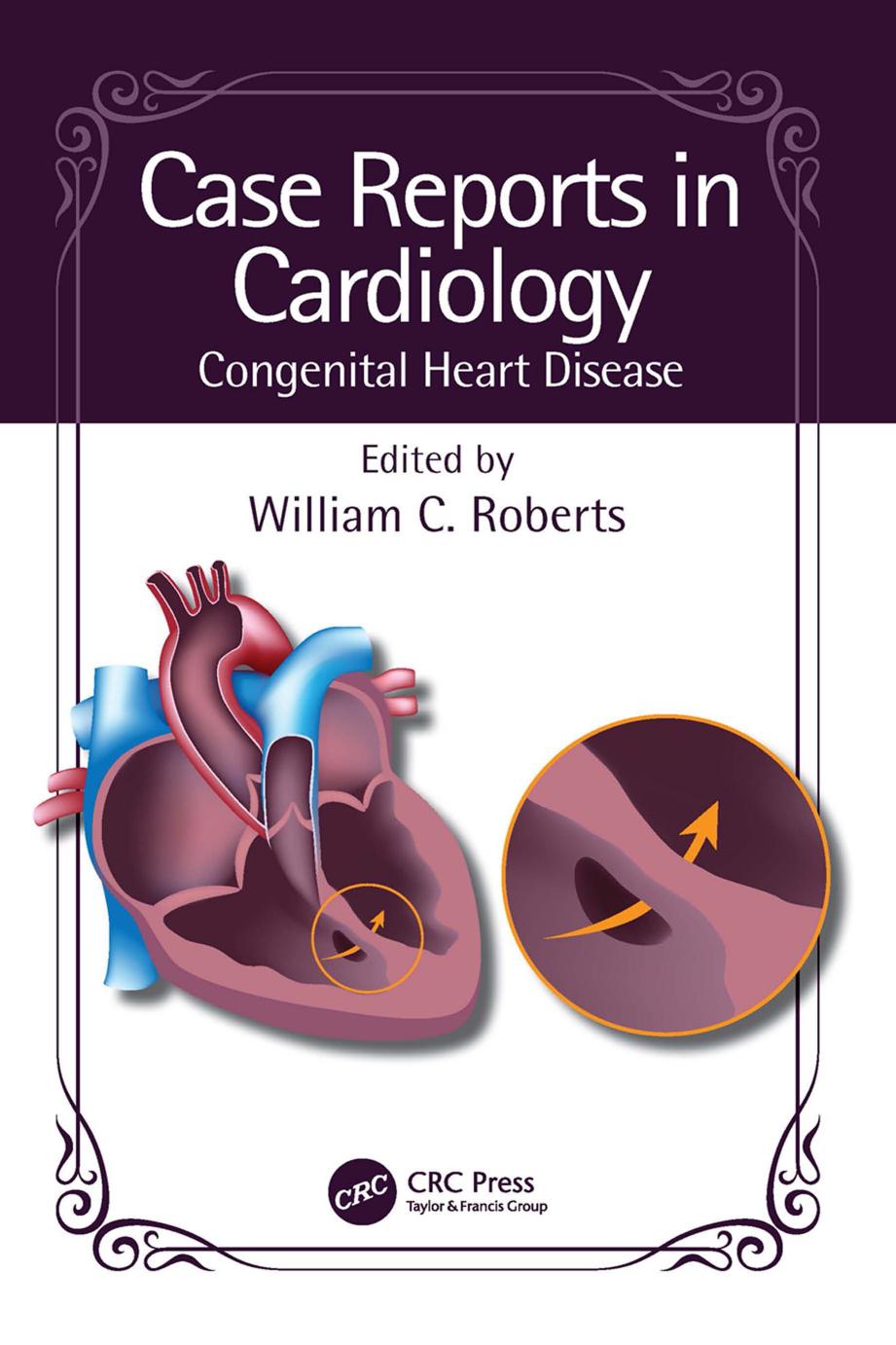 Case Reports In Cardiology Congenital Heart Disease William C Roberts