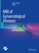 Mri Of Gynaecological Diseases Illustrations And Cases 1st Guofu Zhang