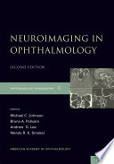 Neuroimaging In Ophthalmology 2nd Edition Michael C Johnson