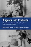 Ringworm And Irradiation The Historical Medical And Legal Implications Of The Forgotten Epidemic Shifra Shvarts