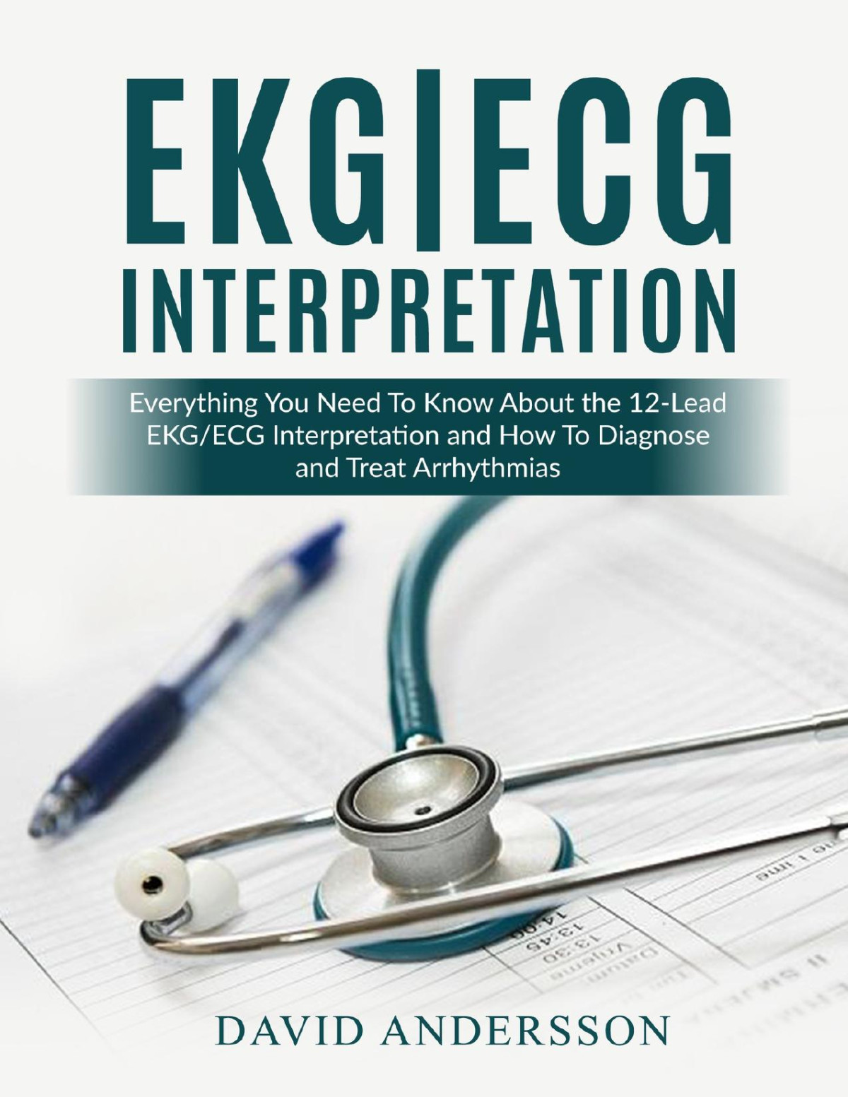 Ekgecg Interpretation Everything You Need To Know About The 12 Lead Ecgekg Interpretation And How To Diagnose And Treat Arrhythmias Andersson