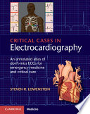 Critical Cases In Electrocardiography 1st Edition Lowenstein