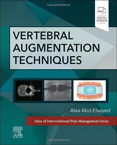 Vertebral Augmentation Techniques 1st Edition Alaa Abdelsayed Md Mph Fasa