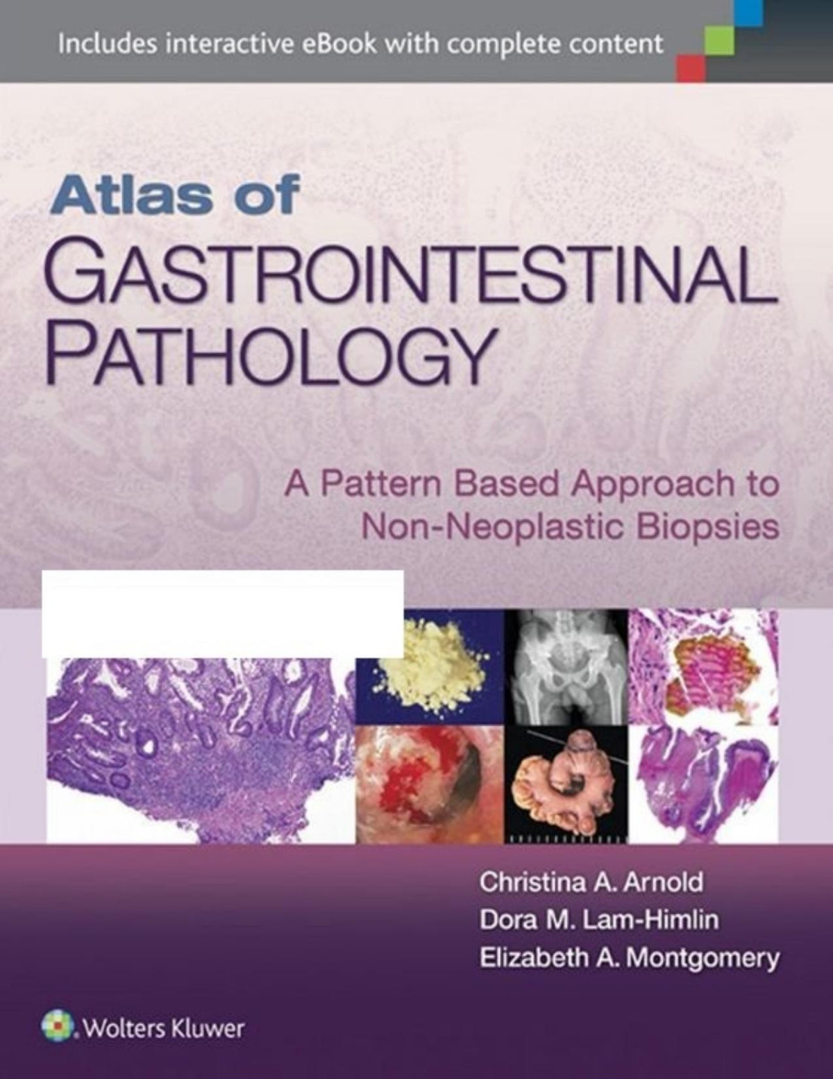 Atlas Of Gastrointestinal Pathology A Pattern Based Approach To Nonneoplastic Biopsies First Arnold