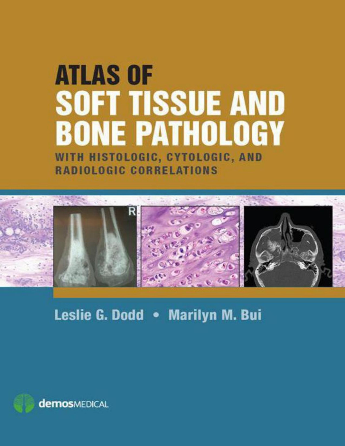 Atlas Of Soft Tissue And Bone Pathology Leslie G Dodd Md Marilyn Bui Md Phd