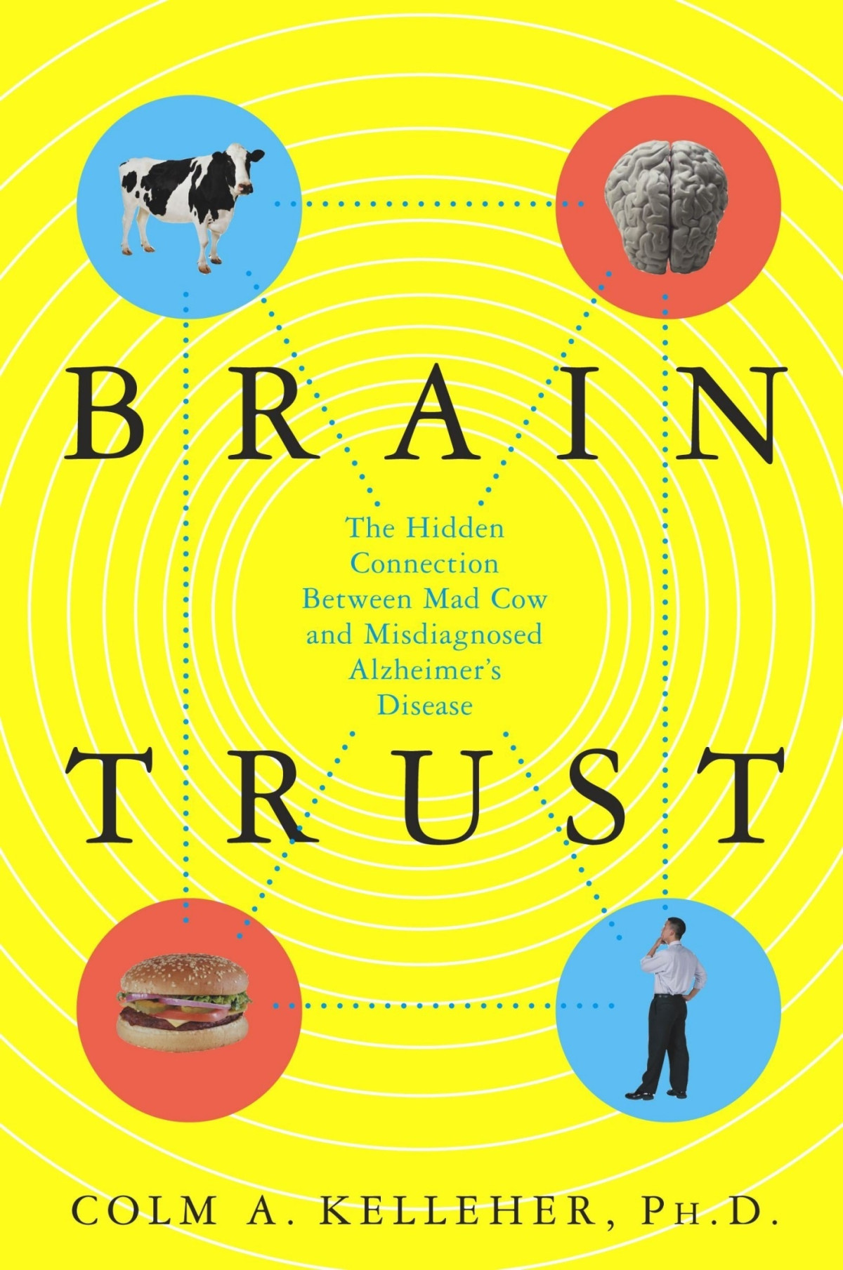 Brain Trust The Hidden Connection Between Mad Cow And Misdiagnosed Alzheimers Disease Colm A Kelleher