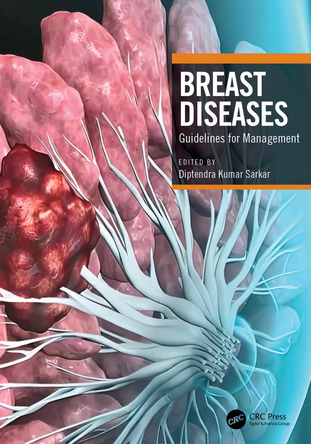 Breast Diseases Guidelines For Management Diptendra Kumar Sarkar