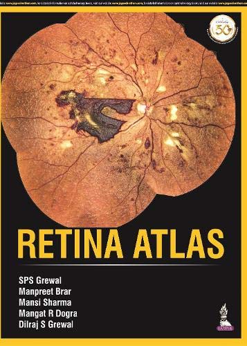 Retina Atlas Apr 1 20209389587433jaypee Brothers Medical Pub Grewal